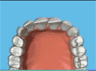 the London Dentist Studio braces treatment information