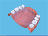 the London Dentist Studio denture treatment information