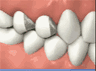 the London Dentist Studio fillings treatment information