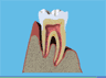 the London Dentist Studio gumdisease treatment information
