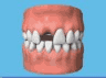the London Dentist Studio implants treatment information