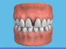 the London Dentist Studio makeover treatment information