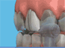 the London Dentist Studio veneers treatment information