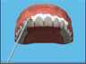 the London Dentist Studio whitening treatment information