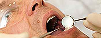 dental exam