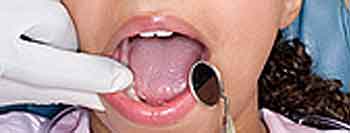 dental exam